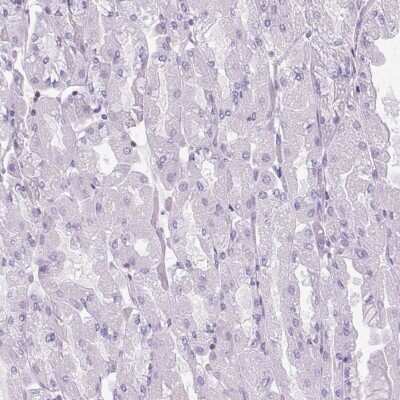 Immunohistochemistry-Paraffin: S100A2 Antibody [NBP2-38959] - Staining of human stomach shows low expression as expected.