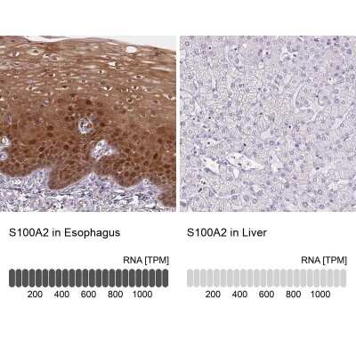 Immunohistochemistry-Paraffin: S100A2 Antibody [NBP2-38959] - Analysis in human esophagus and liver tissues. Corresponding S100A2 RNA-seq data are presented for the same tissues.