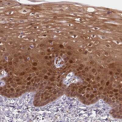 Immunohistochemistry-Paraffin: S100A2 Antibody [NBP2-38959] - Staining of human esophagus shows strong cytoplasmic and nuclear positivity in squamous epithelial cells.