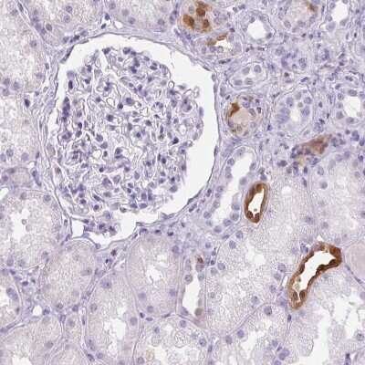 Immunohistochemistry-Paraffin: S100A2 Antibody [NBP2-38959] - Staining of human kidney shows moderate cytoplasmic and nuclear positivity in a subset of cells in tubules.