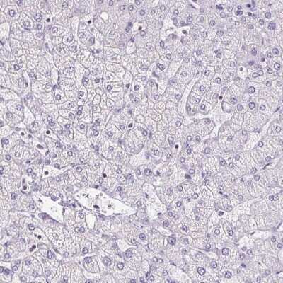 <b>Orthogonal Strategies Validation. </b>Immunohistochemistry-Paraffin: S100A2 Antibody [NBP2-38959] - Staining of human liver shows no positivity in hepatocytes as expected.