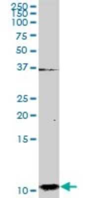 Western Blot: S100A2 Antibody [H00006273-D01P] - Analysis of S100A2 expression in human pancreas.