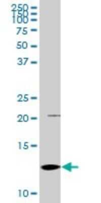 Western Blot: S100A2 Antibody [H00006273-D01P] - Analysis of S100A2 expression in mouse liver.