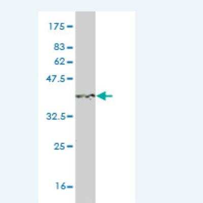 Western Blot: S100A3 Antibody (1D4) [H00006274-M01] - Detection against Immunogen (36.85 KDa) .