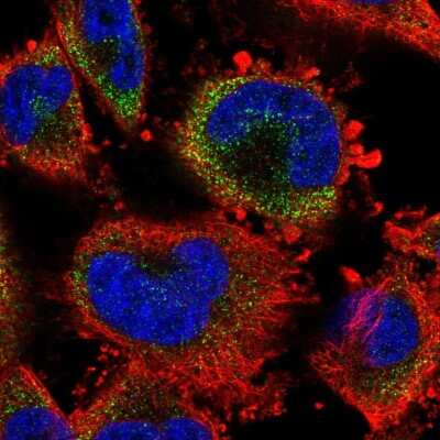 Immunocytochemistry/Immunofluorescence: S100A3 Antibody [NBP2-55369] - Staining of human cell line U-251 MG shows localization to cytosol.