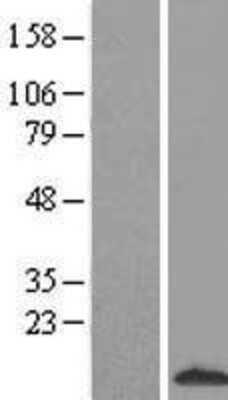 Western Blot: S100A3 Overexpression Lysate (Adult Normal) [NBL1-15655] Left-Empty vector transfected control cell lysate (HEK293 cell lysate); Right -Over-expression Lysate for S100A3.