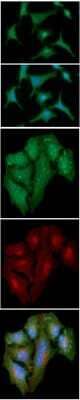 Immunocytochemistry/Immunofluorescence: S100A4 Antibody (1C3) [NBP2-59398] - Analysis of S100A4 in A549 cells line, stained with DAPI (Blue) for nucleus staining and monoclonal anti-human S100A4 antibody (1:100) with goat anti-mouse IgG-Alexa fluor 488 conjugate (Green). Analysis of S100A4 in HeLa cells line, stained with DAPI (Blue) for nucleus staining, Wheat germ agglutinin (WGA) with fluorescein conjugate (Red) for plasma membrane staining and monoclonal anti-human S100A4 antibody (1:500) with goat anti-mouse IgG-Alexa fluor 488 conjugate (Green).