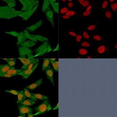 Immunocytochemistry/Immunofluorescence: S100A4 Antibody (S100A4/1481) - Azide and BSA Free [NBP2-54580] - Immunofluorescence staining of HeLa cells using S100A4 Antibody (S100A4/1481) followed by goat anti-Mouse IgG conjugated to CF488 (green). Nuclei are stained with Red Dot.