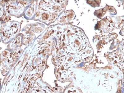 Immunohistochemistry-Paraffin: S100A4 Antibody (S100A4/2750R) - Azide and BSA Free [NBP3-08460] - Formalin-fixed, paraffin-embedded human Placenta stained with S100A4 Recombinant Rabbit Monoclonal Antibody (S100A4/2750R).