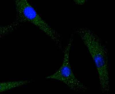 Immunocytochemistry/Immunofluorescence: S100A4 Antibody (SD200-08) [NBP2-67740] - Staining S100A4 in NIH/3T3 cells (green). The nuclear counter stain is DAPI (blue). Cells were fixed in paraformaldehyde, permeabilised with 0.25% Triton X100/PBS.