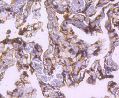 Immunohistochemistry-Paraffin: S100A4 Antibody (SD200-08) [NBP2-67740] - Analysis of paraffin-embedded human lung tissue using anti-S100A4 antibody. Counter stained with hematoxylin.