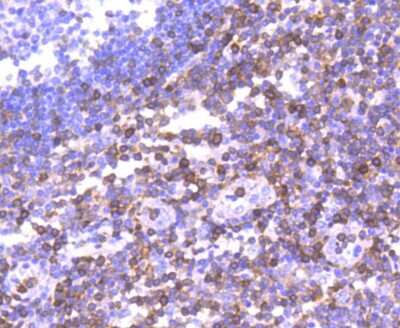 Immunohistochemistry-Paraffin: S100A4 Antibody (SD200-08) [NBP2-67740] - Analysis of paraffin-embedded human tonsil tissue using anti-S100A4 antibody. Counter stained with hematoxylin.