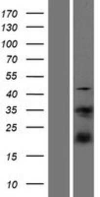 Western Blot: S100A4 Overexpression Lysate (Adult Normal) [NBP2-06702] Left-Empty vector transfected control cell lysate (HEK293 cell lysate); Right -Over-expression Lysate for S100A4.