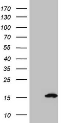 Western Blot: S100A5 Antibody (4C9) [NBP2-45660] - Analysis of HEK293T cells were transfected with the pCMV6-ENTRY control (Left lane) or pCMV6-ENTRY S100A5.