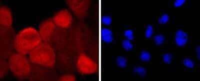 Immunocytochemistry/Immunofluorescence: S100A6 Antibody (JF0976) [NBP2-67123] - Staining S100 alpha 6 in A431 cells (red). The nuclear counter stain is DAPI (blue). Cells were fixed in paraformaldehyde, permeabilised with 0.25% Triton X100/PBS.