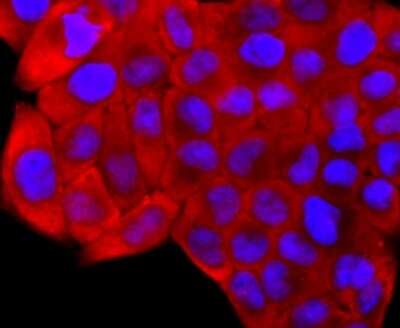 Immunocytochemistry/Immunofluorescence: S100A6 Antibody (JF0976) [NBP2-67123] - Staining S100 alpha 6 in Hela cells (red). The nuclear counter stain is DAPI (blue). Cells were fixed in paraformaldehyde, permeabilised with 0.25% Triton X100/PBS.