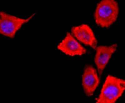 Immunocytochemistry/Immunofluorescence: S100A6 Antibody (JF0976) [NBP2-67123] - Staining S100 alpha 6 in SH-SY-5Y cells (red). The nuclear counter stain is DAPI (blue). Cells were fixed in paraformaldehyde, permeabilised with 0.25% Triton X100/PBS.