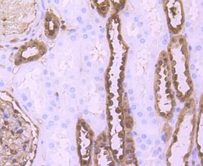 Immunohistochemistry-Paraffin: S100A6 Antibody (JF0976) [NBP2-67123] - Analysis of paraffin-embedded human kidney tissue using anti-S100 alpha 6 antibody. Counter stained with hematoxylin.