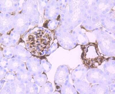 Immunohistochemistry-Paraffin: S100A6 Antibody (JF0976) [NBP2-67123] - Analysis of paraffin-embedded mouse kidney tissue using anti-S100 alpha 6 antibody. Counter stained with hematoxylin.