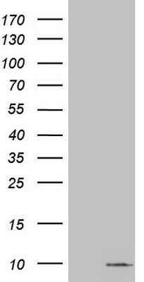 Western Blot: S100A6 Antibody (OTI5A10) - Azide and BSA Free [NBP2-73969] - Analysis of HEK293T cells were transfected with the pCMV6-ENTRY control (Left lane) or pCMV6-ENTRY S100A6.