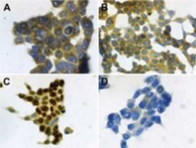 Immunohistochemistry: S100A7/Psoriasin Antibody (47C1068) - Azide Free [NBP2-24911] - Psoriasin (HID5/S100A7) immunocytochemical detection was performed on (A) untreated and (B) LPS-treated (100 ng/ml, 21 hrs) HOPE-fixed human bronchial epithelial (NCI-H727) cells. (D) Negative control was included omitting the primary antibody.