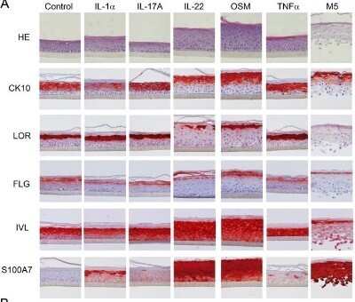 Immunohistochemistry: S100A7/Psoriasin Antibody (47C1068) - Azide Free [NBP2-24911] - Activities of proinflammatory cytokines on the differentiation of Reconstituted Human Epidermis. RHE have been cultured for 10 days at the air-water interface using an appropriate differentiation medium and then with or without recombinant IL-1alpha, IL-17A, IL-22, OSM or TN alpha alone or in combination during 72 h for immunohistological analysis. RHE were fixed, embedded in paraffin and 4 um vertical sections were stained with Hematoxylin and Eosin (HE) or with anti-CK10, anti-LOR, anti-FLG, anti-IVL or anti-S100A7 mAbs. Results are from one experiment representative of two. Image collected and cropped by CiteAb from the following publication (//dx.plos.org/10.1371/journal.pone.0101937), licensed under a CC-BY license. Image using the standard format of this product.