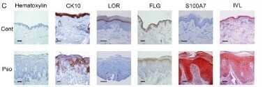 Immunohistochemistry: S100A7/Psoriasin Antibody (47C1068) - Azide Free [NBP2-24911] - Inhibition of KDM expression in vivo. Skin biopsies from normal control skin (Cont) or lesional psoriatic skin (Pso) were collected. Skin sections were stained with Hematoxylin and immunodetection of cytokeratin 10, loricrin, filaggrin, involucrin and S100A7 was performed. Scale bar 100 um. Results are from one experiment representative of three. Image collected and cropped by CiteAb from the following publication (//dx.plos.org/10.1371/journal.pone.0101937), licensed under a CC-BY license. Image using the standard format of this product.