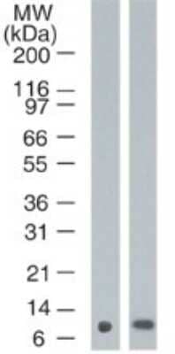 Western Blot: S100A7/Psoriasin Antibody (47C1068) - Azide Free [NBP2-24911] - analysis of psoriasin in A) MCF10A and B) MCF7 cell lysate using psoriasin antibody at 1 ug/ml.
