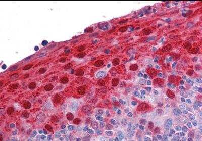 Immunohistochemistry-Paraffin: S100A7/Psoriasin Antibody [NB100-40802] - Staining of Human Tonsil. Steamed antigen retrieval with citrate buffer pH 6, AP-staining.