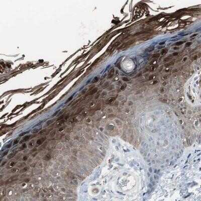 Immunohistochemistry-Paraffin: S100A7/Psoriasin Antibody [NBP1-87205] - Staining of human skin shows strong nuclear and cytoplasmic positivity in a subset of epidermal cells.