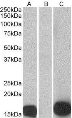 Western Blot: S100A7/Psoriasin Antibody [NB100-40802] - HEK293 lysate (10ug protein in RIPA buffer) overexpressing Human S100A7 with C-terminal MYC tag probed with (0.5ug/ml) in Lane A and probed with anti-MYC Tag (1/1000) in lane C. Mock-transfected HEK293 probed with (1mg/ml) in Lane B.
