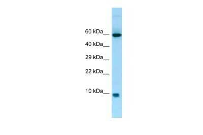 Western Blot S100A7A Antibody