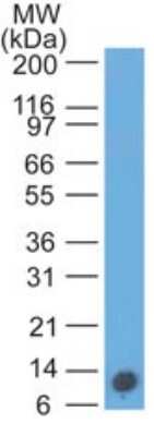 Western Blot: S100A8/A9 Antibody (48M5F4) [NBP2-25260] - Analysis of S100A8 in recombinant protein using S1008A antibody at 0.5 ug/ml. Goat anti-mouse Ig HRP secondary antibody and PicoTect ECL substrate solution were used for this test.