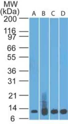 Western Blot: S100A8/A9 Antibody (48M7C7) - Azide Free [NBP2-25269] - analysis of S100A8 in A) recombinant protein, B) human spleen, C) HL60 and D) PC3 lysate using S1008A antibody at 0.5 ug/ml. goat anti-mouse Ig HRP secondary antibody and PicoTect ECL substrate solution were used for this test.