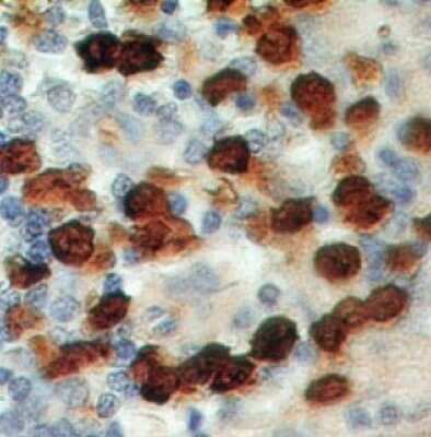 Immunohistochemistry-Paraffin: S100A8/A9 Antibody (48M7F9) [Azide Free] [NBP2-25270] - Formalin-fixed, paraffin-embedded human spleen stained with S100A8 antibody (2 ug/ml), peroxidase-conjugate and DAB chromogen. TMA was used for this test.