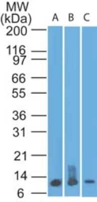 Western Blot: S100A8/A9 Antibody (48M7F9) [Azide Free] [NBP2-25270] - analysis of S100A8 in A) recombinant protein, B) human spleen, and C) HL60 lysate using S1008A antibody at 0.5 ug/ml. goat anti-mouse Ig HRP secondary antibody and PicoTect ECL substrate solution were used for this test.