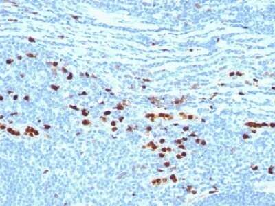 Immunohistochemistry-Paraffin: S100A8/A9 Antibody (MRP8 7C12/4) - Azide and BSA Free [NBP2-47667] - Human Tonsil stained with Macrophage L1 Protein Monoclonal Antibody (MAC387)