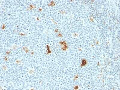Immunohistochemistry-Paraffin: S100A8/A9 Antibody (SPM281) [NBP2-45296] - Human Tonsil stained with Macrophage L1 Protein Monoclonal Antibody (SPM281)