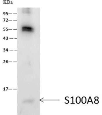 Immunoprecipitation: S100A8 Antibody (203) [NBP2-89806] - Lane A:0.5 mg HL-60 Whole Cell Lysate 1 uL anti-S100A8 rabbit monoclonal antibody and 60 ug of Immunomagnetic beads Protein A/G. Primary antibody:Anti-S100A8 rabbit monoclonal antibody,at 1:500 dilution  Secondary antibody:Goat Anti-Rabbit IgG (H+L)/HRP at 1/10000 dilution Developed using the ECL technique. Performed under reducing conditions. Predicted band size: 11 kDaObserved band size :11 kDa