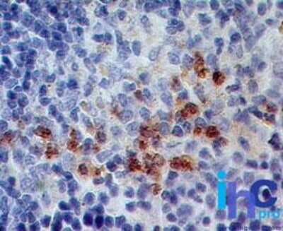 Immunohistochemistry-Paraffin: S100A8 Antibody (63N13G5) - Azide Free [NBP2-25273] - Formalin-fixed, paraffin-embedded mouse spleen stained with S100A8 antibody (5 ug/ml), peroxidase-conjugate and DAB chromogen.