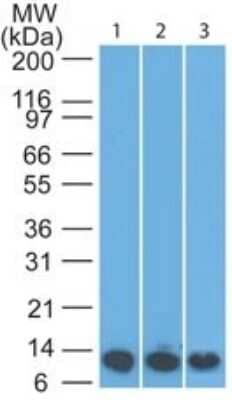 Western Blot: S100A8 Antibody (63N13G5) - Azide Free [NBP2-25273] - analysis of S100A8 in 1) recombinant protein 2) mouse spleen and 3) mouse lung lysate using S1008A antibody at 1 ug/ml. goat anti-rat Ig HRP secondary antibody and PicoTect ECL substrate solution were used for this test.