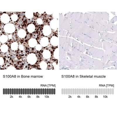 <b>Orthogonal Strategies Validation. </b>Immunohistochemistry-Paraffin: S100A8 Antibody (CL11171) [NBP3-07985] - Analysis in human bone marrow and skeletal muscle tissues using NBP3-07985 antibody. Corresponding S100A8 RNA-seq data are presented for the same tissues.