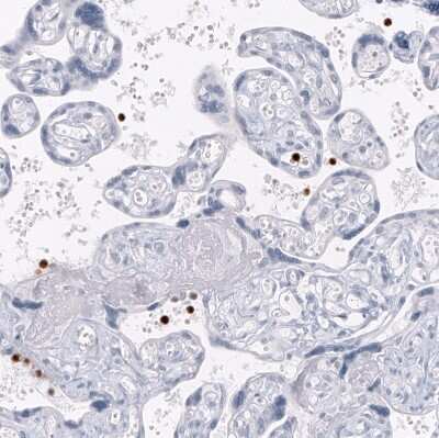 Immunohistochemistry-Paraffin: S100A8 Antibody (CL11171) [NBP3-07985] - Staining of human placenta shows strong cytoplasmic positivity in a subset of lymphoid cells.