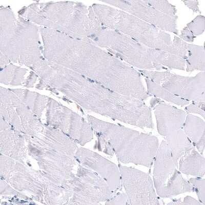 Immunohistochemistry-Paraffin: S100A8 Antibody (CL11171) [NBP3-07985] - Staining of human skeletal muscle shows no positivity in myocytes as expected.