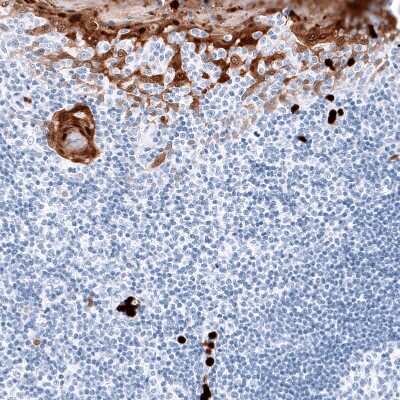 Immunohistochemistry-Paraffin: S100A8 Antibody (CL11171) [NBP3-07985] - Staining of human tonsil shows moderate to strong cytoplasmic positivity in squamous epithelial cells.