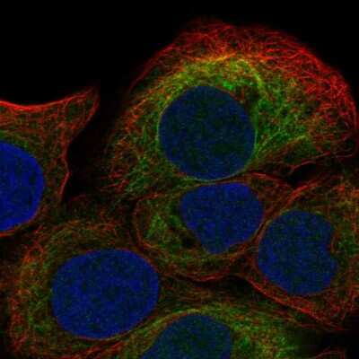 Immunocytochemistry/Immunofluorescence: S100A8 Antibody [NBP1-90314] - Staining of human cell line HaCaT shows localization to intermediate filaments. Antibody staining is shown in green.