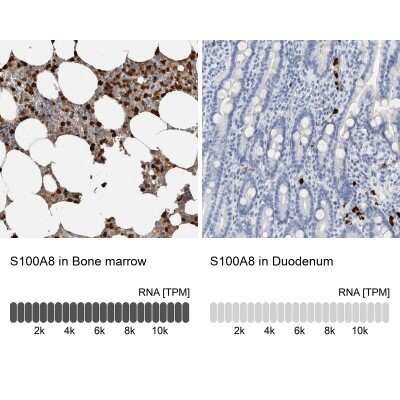 Immunohistochemistry-Paraffin: S100A8 Antibody [NBP1-90314] - Staining in human bone marrow and duodenum tissues using anti-S100A8 antibody. Corresponding S100A8 RNA-seq data are presented for the same tissues.