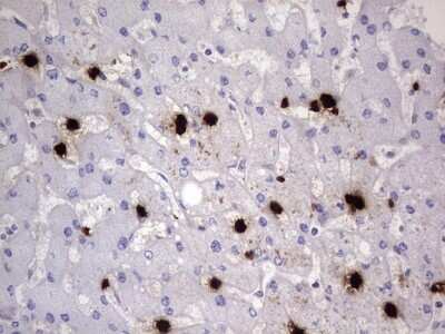 Immunohistochemistry: S100A9 Antibody (10D5) [NBP2-45662] - Analysis of Human liver tissue. (Heat-induced epitope retrieval by 1 mM EDTA in 10mM Tris, pH8.5, 120C for 3min)