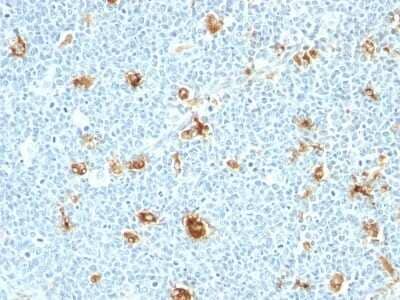 Immunohistochemistry-Paraffin: S100A9 Antibody (CAGB/426) [NBP2-44911] - Human Tonsil stained with Calgranulin B Monoclonal Antibody (CAGB/426)