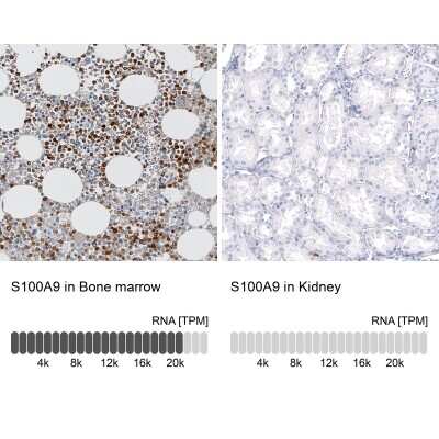 <b>Orthogonal Strategies Validation. </b>Immunohistochemistry-Paraffin: S100A9 Antibody (CL11191) [NBP3-07983] - Analysis in human bone marrow and kidney tissues using NBP3-07983 antibody. Corresponding S100A9 RNA-seq data are presented for the same tissues.